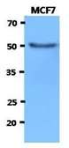 Anti-HEXA antibody [AT20F1] used in Western Blot (WB). GTX53726
