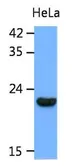 Anti-Park7 / DJ-1 antibody [AT1E12] used in Western Blot (WB). GTX53756