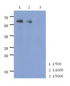 Anti-PARP2 antibody [AT29G4] used in Western Blot (WB). GTX53758