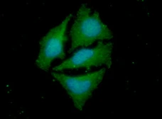 Anti-PPM1A antibody [p6c7] used in Immunocytochemistry/ Immunofluorescence (ICC/IF). GTX53766