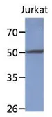 Anti-PPM1F antibody [AT6D11] used in Western Blot (WB). GTX53769