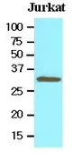Anti-Tollip antibody [k1B17] used in Western Blot (WB). GTX53793
