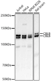 Anti-Cbl-b antibody used in Western Blot (WB). GTX53915