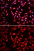 Anti-CBR1 antibody used in Immunocytochemistry/ Immunofluorescence (ICC/IF). GTX53925