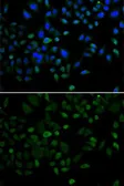 Anti-CBX8 antibody used in Immunocytochemistry/ Immunofluorescence (ICC/IF). GTX53929