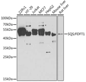 Anti-FDFT1 antibody used in Western Blot (WB). GTX53976