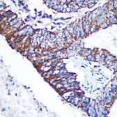 Anti-DOK4 antibody used in IHC (Paraffin sections) (IHC-P). GTX53984