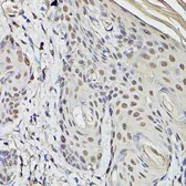 Anti-PEA3 antibody used in IHC (Paraffin sections) (IHC-P). GTX54006