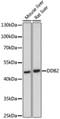Anti-DDB2 antibody used in Western Blot (WB). GTX54039