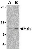 Anti-Hrk antibody used in Western Blot (WB). GTX54049