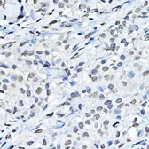 Anti-Histone H3K27me1 (mono-methyl Lys27) antibody used in IHC (Paraffin sections) (IHC-P). GTX54104