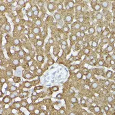 Anti-GARS antibody used in Immunocytochemistry/ Immunofluorescence (ICC/IF). GTX54147