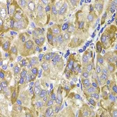 Anti-MAGED1 antibody used in IHC (Paraffin sections) (IHC-P). GTX54316