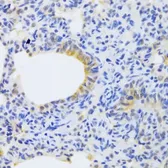 Anti-MRPS30 antibody used in IHC (Paraffin sections) (IHC-P). GTX54320