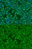 Anti-IGF2BP1 antibody used in Immunocytochemistry/ Immunofluorescence (ICC/IF). GTX54359