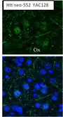 Anti-Huntingtin (neoepitope 552) antibody used in IHC (Frozen sections) (IHC-Fr). GTX54521