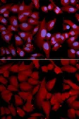Anti-PSMA4 antibody used in Immunocytochemistry/ Immunofluorescence (ICC/IF). GTX54544