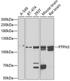 Anti-PTPN3 antibody used in Western Blot (WB). GTX54572