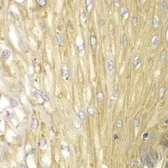 Anti-PPP2R2A antibody used in IHC (Paraffin sections) (IHC-P). GTX54580