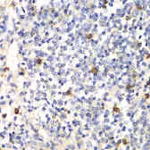 Anti-PSMD7 antibody used in IHC (Paraffin sections) (IHC-P). GTX54625