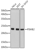 Anti-PSMB2 antibody used in Western Blot (WB). GTX54633