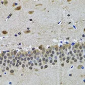 Anti-SPIN1 antibody used in IHC (Paraffin sections) (IHC-P). GTX54689