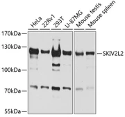 Anti-SKIV2L2 antibody used in Western Blot (WB). GTX54698