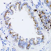Anti-Retinoic Acid Receptor alpha antibody used in IHC (Paraffin sections) (IHC-P). GTX54703
