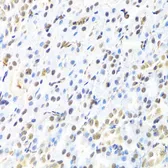 Anti-RUNX1 antibody used in IHC (Paraffin sections) (IHC-P). GTX54704