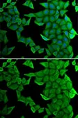 Anti-SMYD2 antibody used in Immunocytochemistry/ Immunofluorescence (ICC/IF). GTX54717