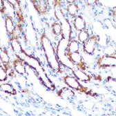 Anti-SGK1 antibody used in IHC (Paraffin sections) (IHC-P). GTX54726