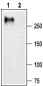 Anti-CACNA1G antibody used in Western Blot (WB). GTX54760