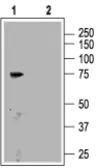 Anti-CNGA3 antibody used in Western Blot (WB). GTX54784