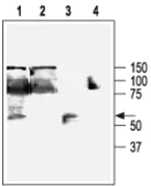 Anti-KCNN4 antibody used in Western Blot (WB). GTX54786