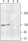 Anti-TrkA antibody used in Western Blot (WB). GTX54856