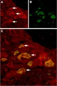 Anti-TRPV6 antibody used in IHC (Frozen sections) (IHC-Fr). GTX54869
