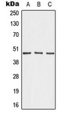 Anti-AKAP5 antibody used in Western Blot (WB). GTX54927