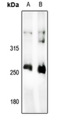 Anti-Acetyl-CoA Carboxylase 1 antibody used in Western Blot (WB). GTX54946