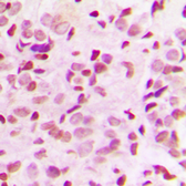 Anti-NFkB p65 (phospho Thr435) antibody used in IHC (Paraffin sections) (IHC-P). GTX54983