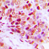 Anti-Splicing factor 1 (phospho Ser82) antibody used in IHC (Paraffin sections) (IHC-P). GTX55031