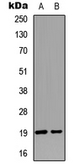 Anti-Stathmin 1 (phospho Ser25) antibody used in Western Blot (WB). GTX55035