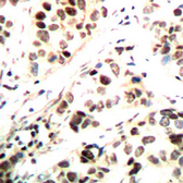 Anti-Chk1 (phospho Ser296) antibody used in IHC (Paraffin sections) (IHC-P). GTX55053