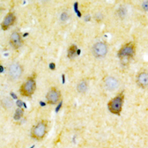 Anti-NMDAR2B (phospho Tyr1336) antibody used in IHC (Paraffin sections) (IHC-P). GTX55068