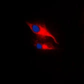 Anti-Lck (phospho Tyr394) antibody used in Immunocytochemistry/ Immunofluorescence (ICC/IF). GTX55100