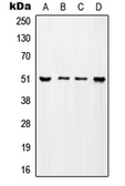 Anti-ADA2a antibody used in Western Blot (WB). GTX55173