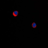 Anti-ARRDC1 antibody used in Immunocytochemistry/ Immunofluorescence (ICC/IF). GTX55210
