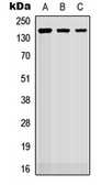 Anti-ROBO2 antibody used in Western Blot (WB). GTX55278