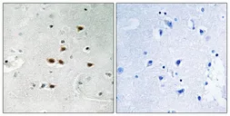 Anti-ITCH (phospho Tyr420) antibody used in IHC (Paraffin sections) (IHC-P). GTX55343