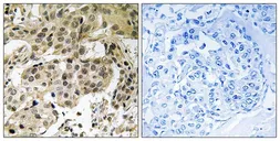Anti-HP1 alpha (phospho Ser92) antibody used in IHC (Paraffin sections) (IHC-P). GTX55344