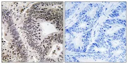 Anti-WWOX (phospho Tyr33) antibody used in IHC (Paraffin sections) (IHC-P). GTX55345